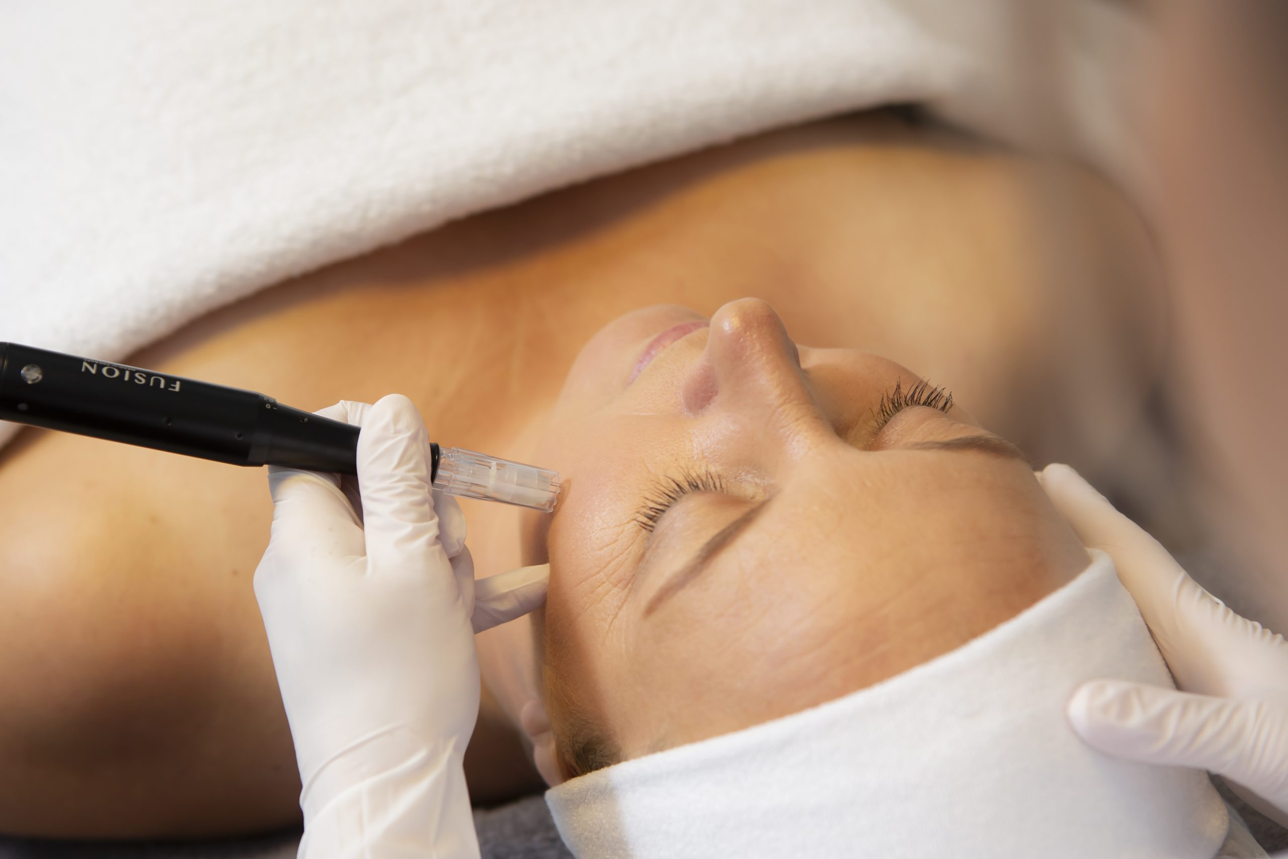 Dermapen Fusion Permanente make up Cosmetisch arts Huidtherapie SkinFix Schoonheidssalon Schoonheidsspecialiste Volkel Uden Veghel Oss Erp Boekel Mill Nistelrode Vorstenbosch Dermapen Fusion