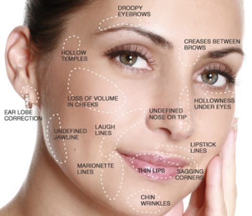 Injectables SkinFix Schoonheidssalon Schoonheidsspecialiste Volkel Uden Veghel Oss Erp Boekel Mill Nistelrode Vorstenbosch Injectables in Volkel Uden