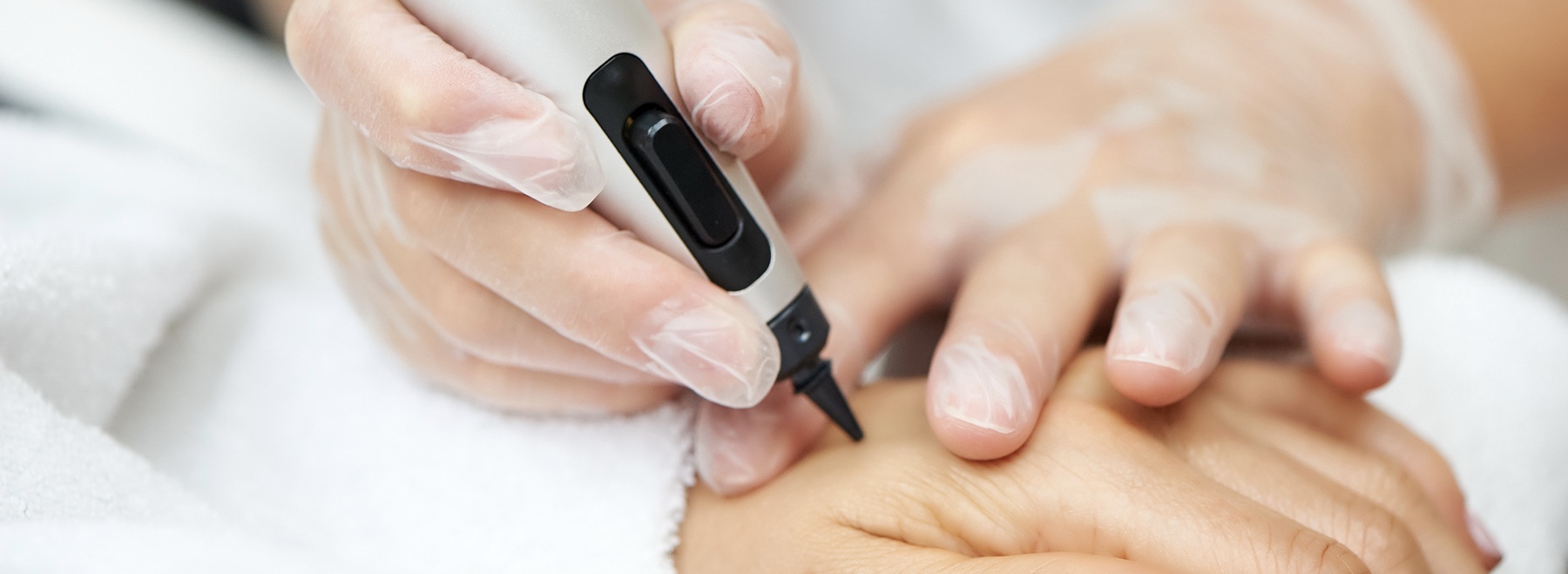 Spot Reducer Cosmetisch arts Huidtherapie SkinFix Schoonheidssalon Schoonheidsspecialiste Volkel Uden Veghel Oss Erp Boekel Mill Nistelrode Vorstenbosch