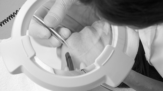 Elektrisch ontharen Medisch Schoonheidsspecialiste Cosmetisch arts PH Formula Skin Resurfacing Permanente make up Cosmetisch arts Huidtherapie SkinFix Schoonheidssalon Schoonheidsspecialiste Volkel Uden Veghel Oss Erp Boekel Mill Nistelrode Vorstenbosch Elektrisch ontharen