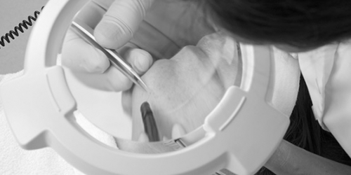 Elektrisch ontharen Medisch Schoonheidsspecialiste Cosmetisch arts PH Formula Skin Resurfacing Permanente make up Cosmetisch arts Huidtherapie SkinFix Schoonheidssalon Schoonheidsspecialiste Volkel Uden Veghel Oss Erp Boekel Mill Nistelrode Vorstenbosch Elektrisch ontharen